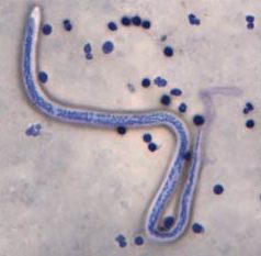 Urine Test Reveals 'River Blindness' Parasite | RealClearScience