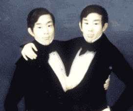 The Sex Lives of Conjoined Twins | RealClearScience