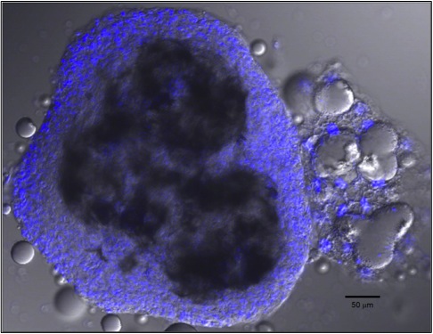 Canser Insect Wasp Research Yields Clues About Cancer | RealClearScience